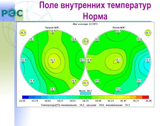 Поле внутренних температур Норма