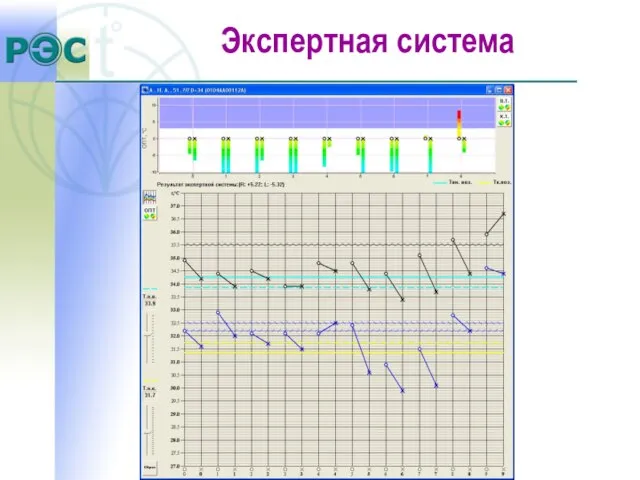 Экспертная система