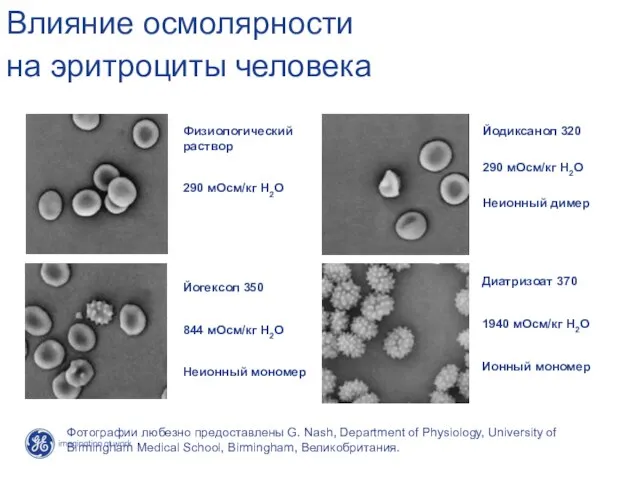 Влияние осмолярности на эритроциты человека Физиологический раствор 290 мОсм/кг H2O Йодиксанол 320