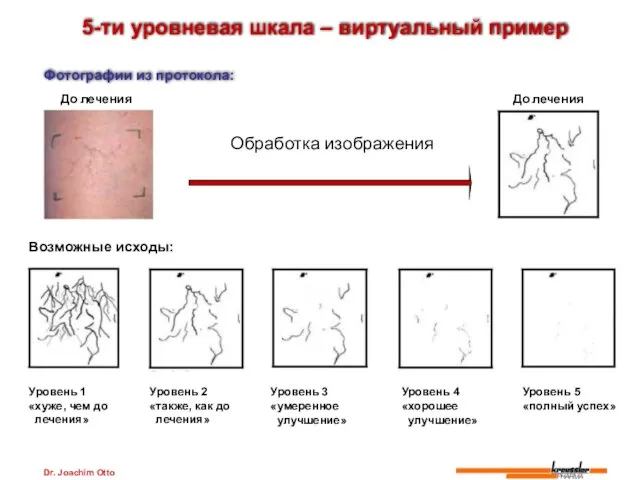 Dr. Joachim Otto 5-ти уровневая шкала – виртуальный пример Фотографии из протокола: