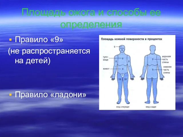 Площадь ожога и способы ее определения Правило «9» (не распространяется на детей) Правило «ладони»