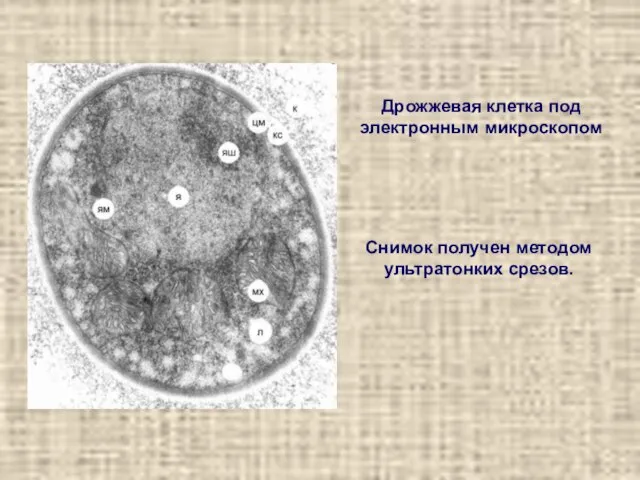 Снимок получен методом ультратонких срезов. Дрожжевая клетка под электронным микроскопом