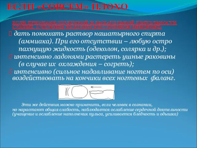 ЕСЛИ «СОВСЕМ» ПЛОХО ЕСЛИ ПРИЗНАКИ СЕРДЕЧНОЙ И ДЫХАТЕЛЬНОЙ ДЕЯТЕЛЬНОСТИ СЛАБЫЕ, А ЧЕЛОВЕК