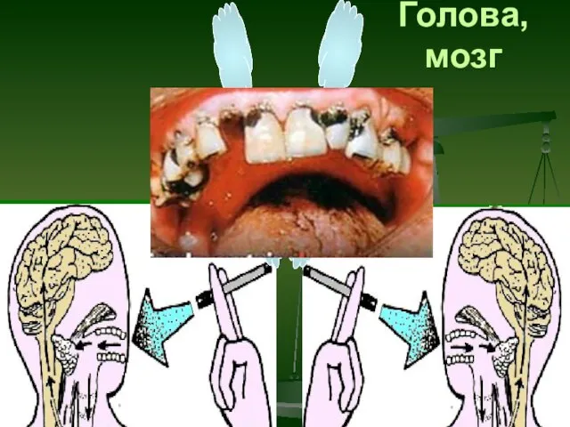 Голова, мозг