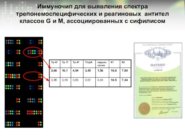 Иммуночип для выявления cпектра трепонемоспецифических и реагиновых антител классов G и M, ассоциированных с сифилисом