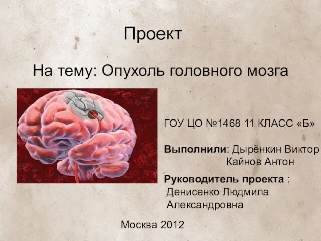 Проект На тему: Опухоль головного мозга ГОУ ЦО №1468 11 КЛАСС «Б»