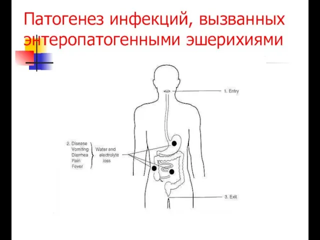 Патогенез инфекций, вызванных энтеропатогенными эшерихиями