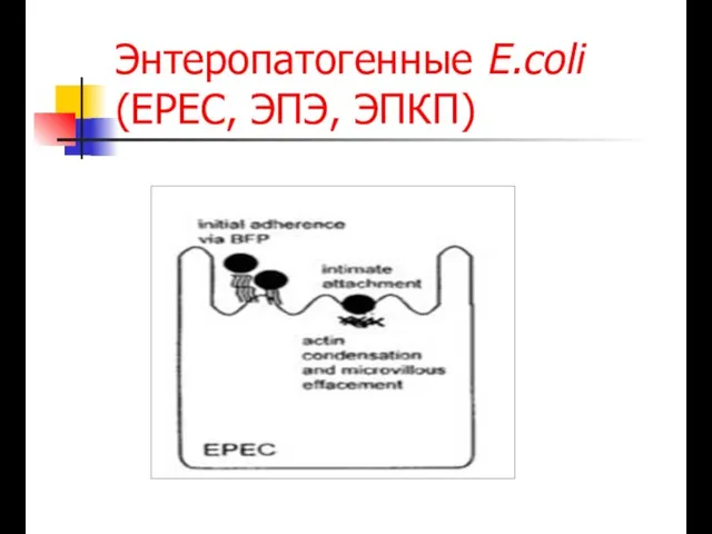 Энтеропатогенные E.coli (EPEC, ЭПЭ, ЭПКП)