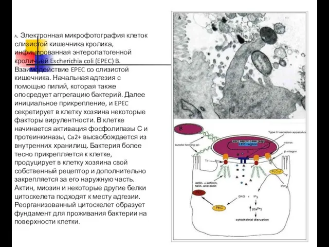 A. Электронная микрофотография клеток слизистой кишечника кролика, инфицированная энтеропатогенной кроличьей Escherichia coli