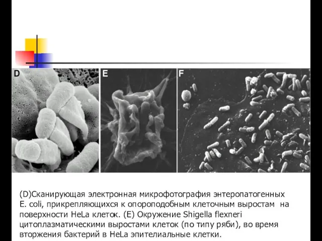 (D)Сканирующая электронная микрофотография энтеропатогенных Е. coli, прикрепляющихся к опороподобным клеточным выростам на