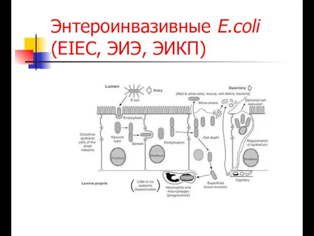 Энтероинвазивные E.coli (EIEC, ЭИЭ, ЭИКП)