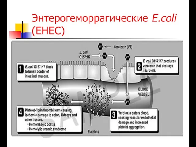 Энтерогеморрагические E.coli (EHEC)