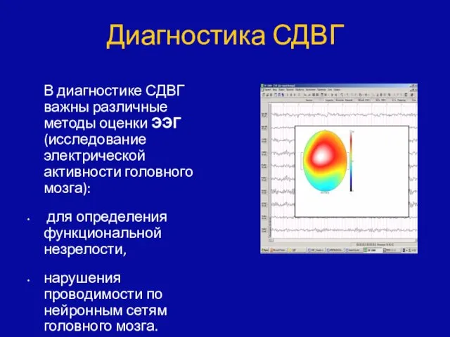 В диагностике СДВГ важны различные методы оценки ЭЭГ (исследование электрической активности головного