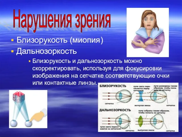 Близорукость (миопия) Дальнозоркость Близорукость и дальнозоркость можно скорректировать, используя для фокусировки изображения