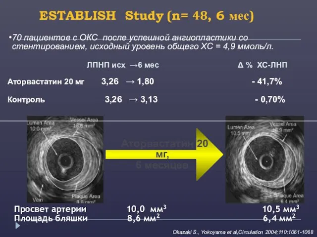 Аторвастатин 20 мг, 6 месяцев Okazaki S., Yokoyama et al,Circulation 2004;110:1061-1068 ЛПНП