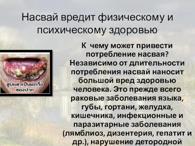 Насвай вредит физическому и психическому здоровью К чему может привести потребление насвая?