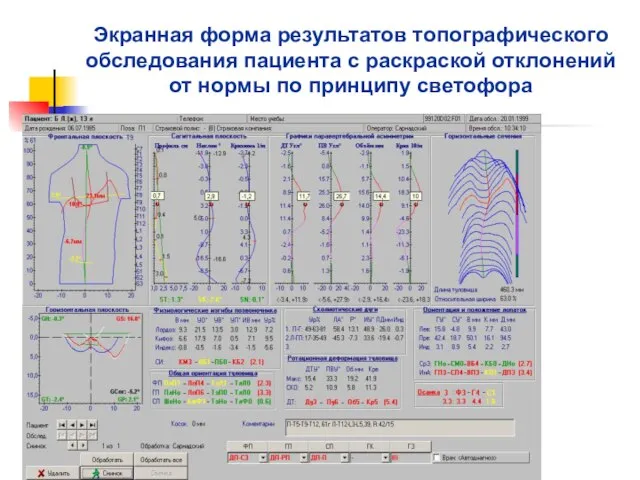 Экранная форма результатов топографического обследования пациента с раскраской отклонений от нормы по принципу светофора