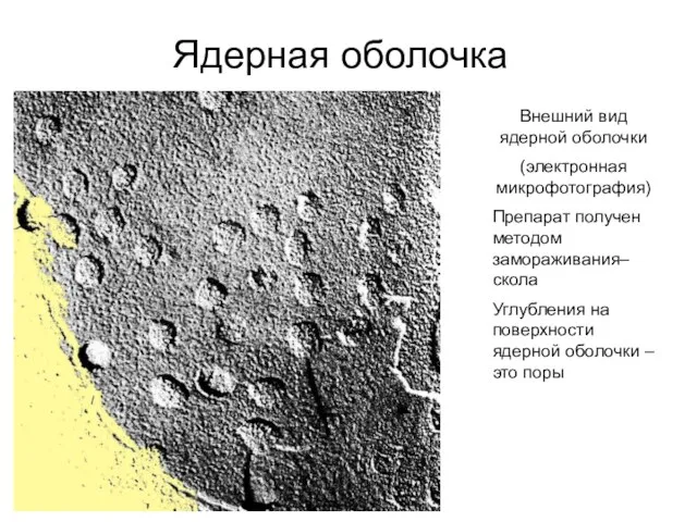 Ядерная оболочка Внешний вид ядерной оболочки (электронная микрофотография) Препарат получен методом замораживания–скола