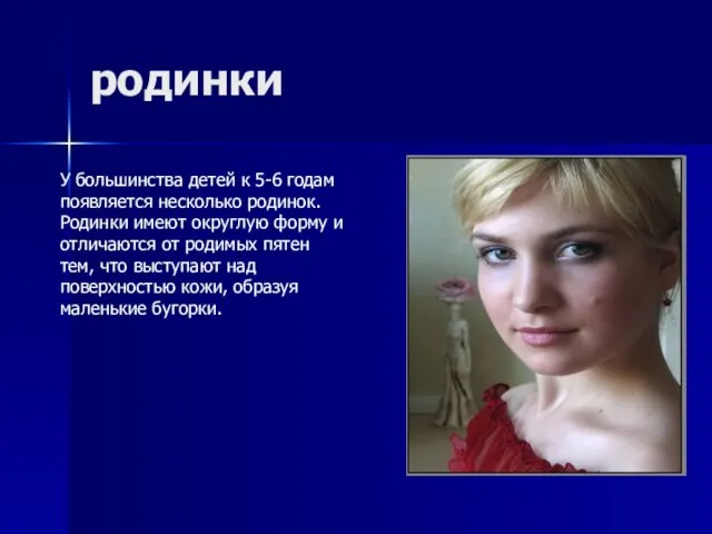 родинки У большинства детей к 5-6 годам появляется несколько родинок. Родинки имеют