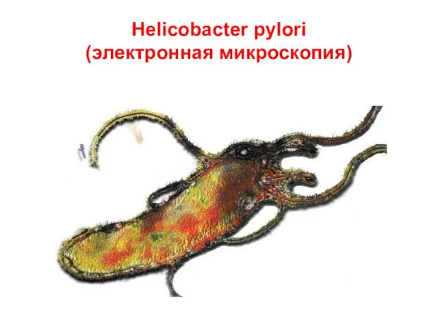 Helicobacter pylori (электронная микроскопия)