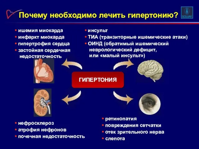 Почему необходимо лечить гипертонию? ишемия миокарда инфаркт миокарда гипертрофия сердца застойная сердечная