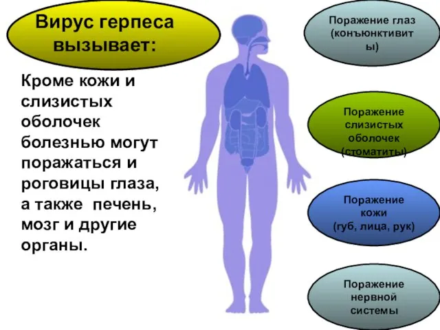 Кроме кожи и слизистых оболочек болезнью могут поражаться и роговицы глаза, а