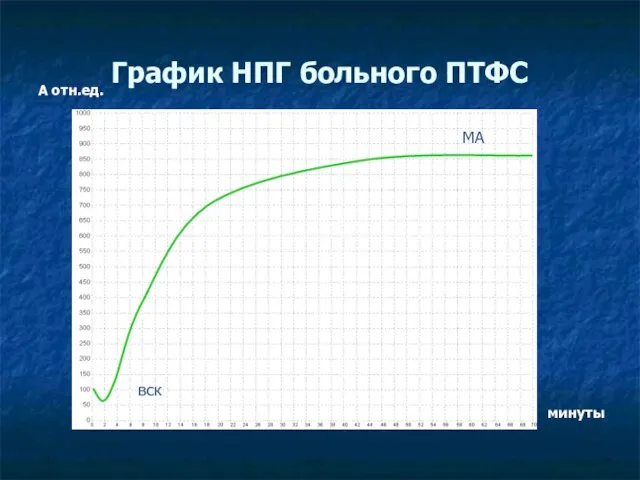 График НПГ больного ПТФС А отн.ед. минуты вск МА