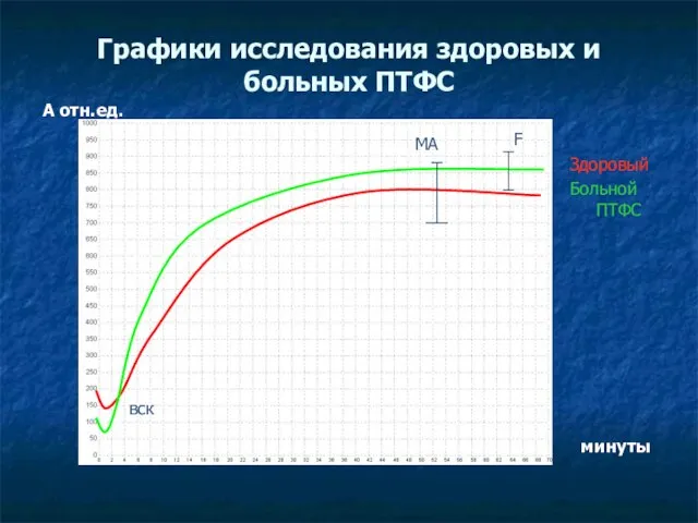 Графики исследования здоровых и больных ПТФС А отн.ед. Здоровый Больной ПТФС минуты MA MA F вск