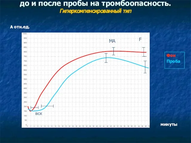 Графики исследования здоровых людей до и после пробы на тромбоопасность. Гиперкомпенсированный тип