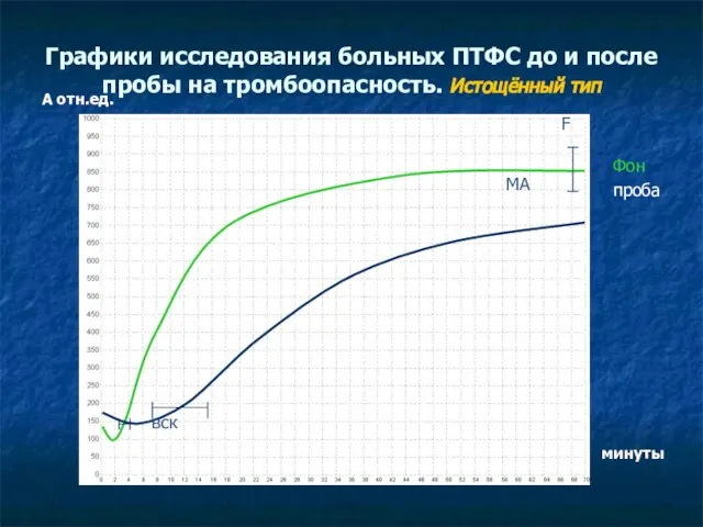 Графики исследования больных ПТФС до и после пробы на тромбоопасность. Истощённый тип