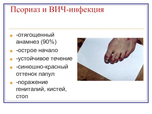 Псориаз и ВИЧ-инфекция -отягощенный анамнез (90%) -острое начало -устойчивое течение -синюшно-красный оттенок