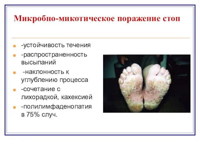 Микробно-микотическое поражение стоп -устойчивость течения -распространенность высыпаний -наклонность к углублению процесса -сочетание