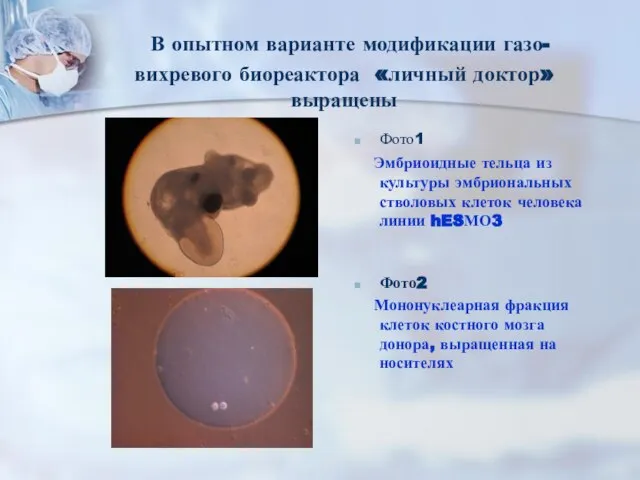В опытном варианте модификации газо-вихревого биореактора «личный доктор» выращены Фото1 Эмбриоидные тельца