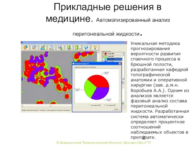 Прикладные решения в медицине. Автоматизированный анализ перитонеальной жидкости. Уникальная методика прогнозирования вероятности