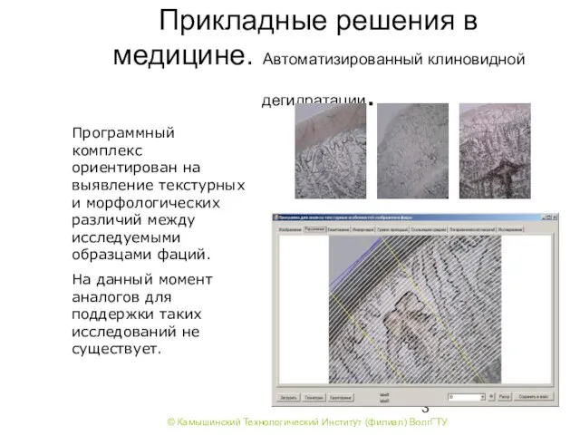 Прикладные решения в медицине. Автоматизированный клиновидной дегидратации. Программный комплекс ориентирован на выявление