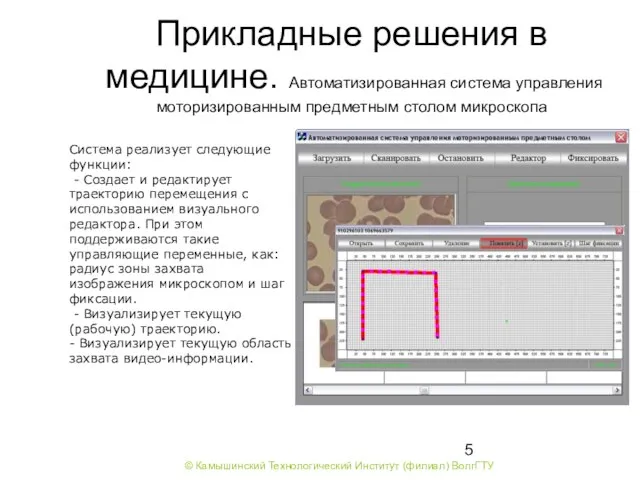 Прикладные решения в медицине. Автоматизированная система управления моторизированным предметным столом микроскопа Система