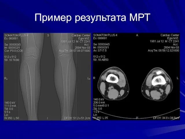 Пример результата МРТ