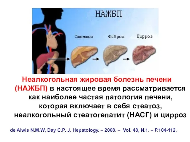 Неалкогольная жировая болезнь печени (НАЖБП) в настоящее время рассматривается как наиболее частая