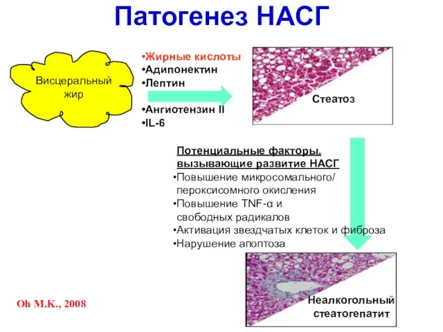 Жирные кислоты Адипонектин Лептин Ангиотензин II IL-6 Потенциальные факторы, вызывающие развитие НАСГ
