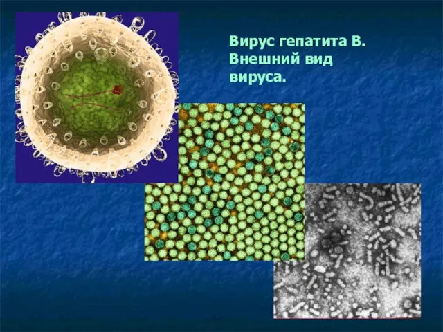 Вирус гепатита В. Внешний вид вируса.