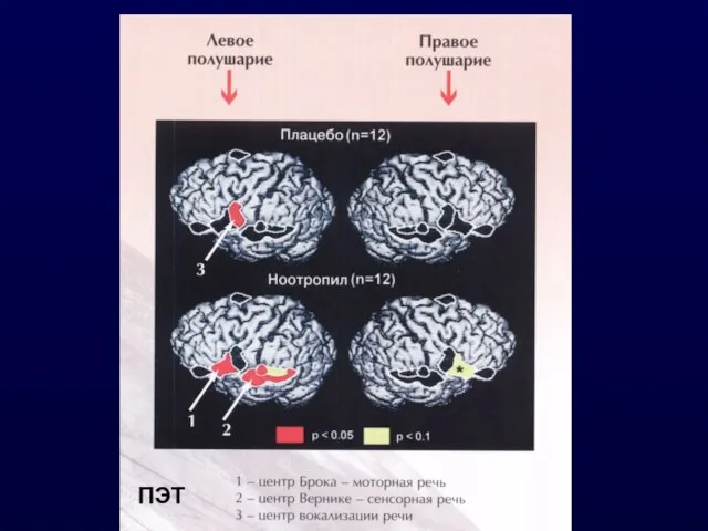 ПЭТ