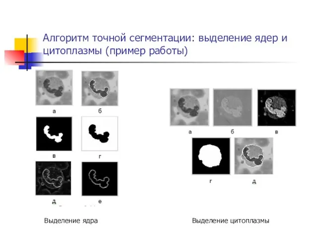 Алгоритм точной сегментации: выделение ядер и цитоплазмы (пример работы) Выделение ядра Выделение цитоплазмы