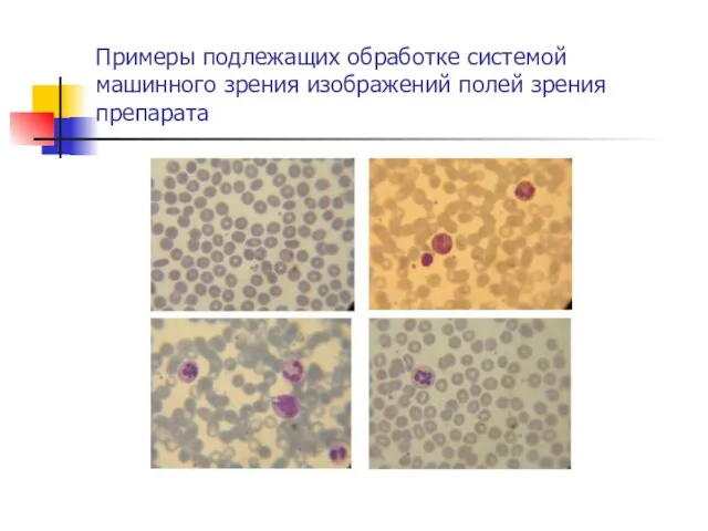 Примеры подлежащих обработке системой машинного зрения изображений полей зрения препарата