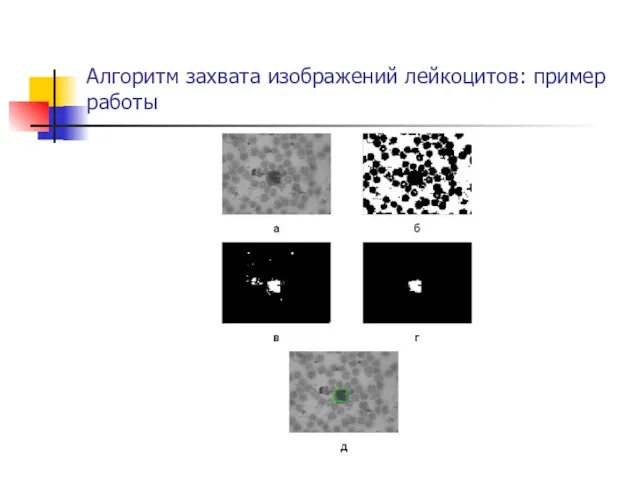 Алгоритм захвата изображений лейкоцитов: пример работы