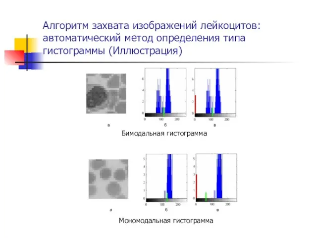 Алгоритм захвата изображений лейкоцитов: автоматический метод определения типа гистограммы (Иллюстрация) Бимодальная гистограмма Мономодальная гистограмма