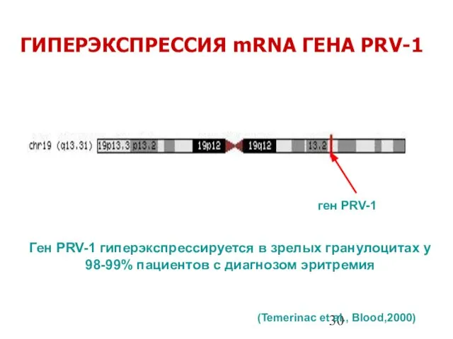 ген PRV-1 ГИПЕРЭКСПРЕССИЯ mRNA ГЕНА PRV-1 Ген PRV-1 гиперэкспрессируется в зрелых гранулоцитах