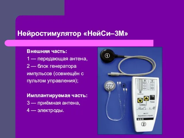 Нейростимулятор «НейСи–3М» Внешняя часть: 1 — передающая антена, 2 — блок генератора