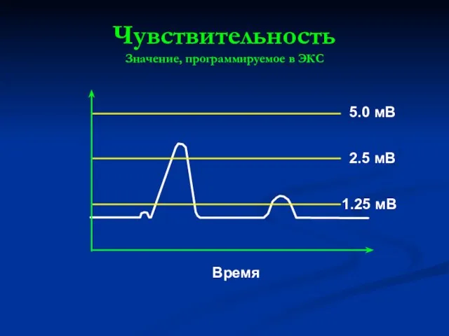 Чувствительность Значение, программируемое в ЭКС Время 5.0 мВ 2.5 мВ 1.25 мВ