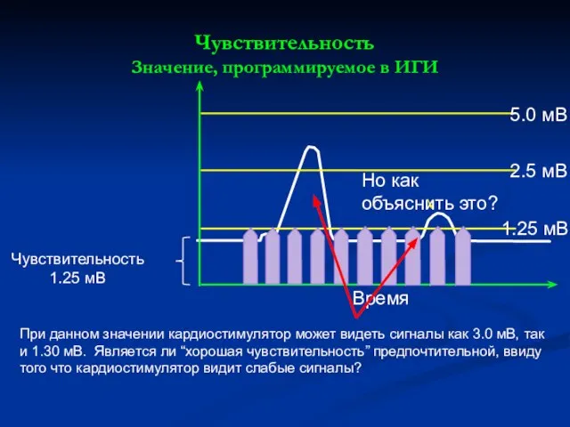 Чувствительность Значение, программируемое в ИГИ При данном значении кардиостимулятор может видеть сигналы