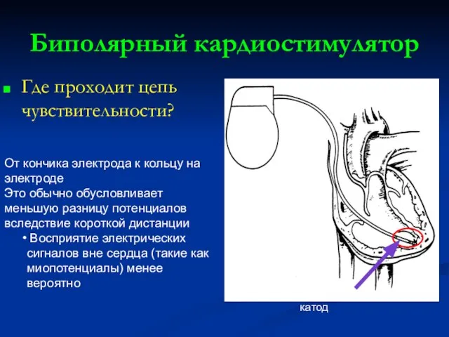 Биполярный кардиостимулятор Где проходит цепь чувствительности? Анод и катод От кончика электрода